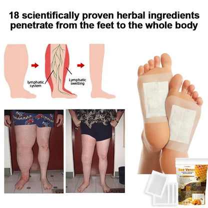 Bee Venom Lymphatic Drainage & Slimming Foot Patches 🌿👣 (10 Patches)
